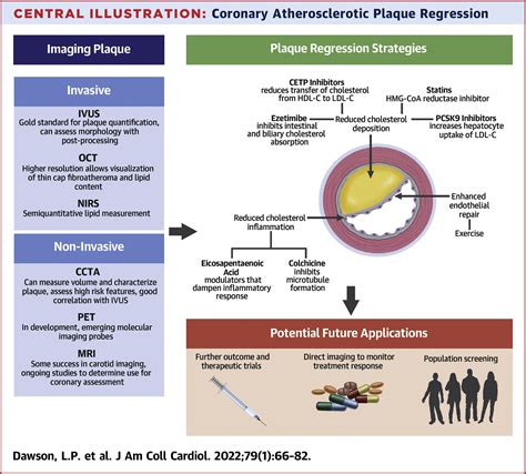 Coronary Atherosclerotic Plaque Regression Jacc State Of The Art