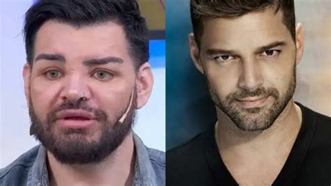 Argentino Passa Por 30 Cirurgias Para Ficar Igualzinho A Ricky Martin E