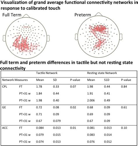 Functional Connectivity Of Neonatal Somatosensory Eeg Networks Predicts