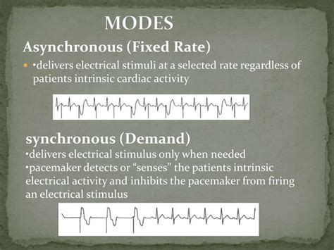 Transcutaneous pacing