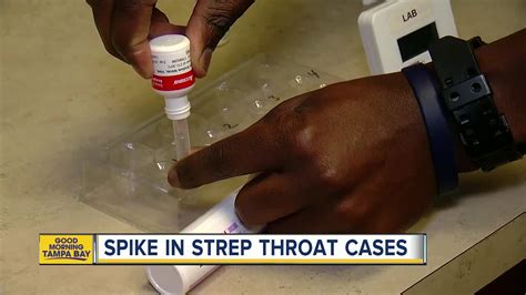 Strep Throat Cases Increase In Hillsborough Co