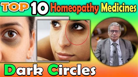 Dark Circles Causes And Homeopathy Treatment Dr P S Tiwari Youtube