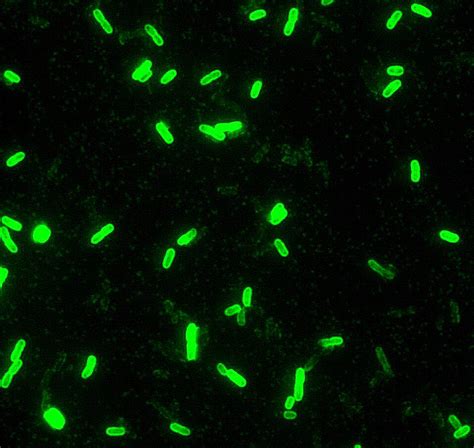 Free Picture Yersinia Pestis Direct Fluorescent Antibody Stain 100x Magnification