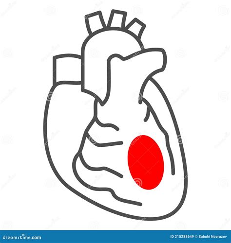 Infarto De Miocardio Línea Delgada Icono Enfermedades Humanas Concepto