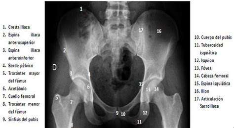 Anatomía Radiológica Abdomen y Pelvis Radiología La pelvis