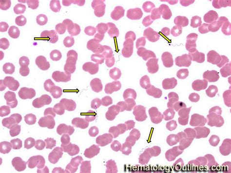 HematologyOutlines - Atlas