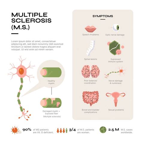 Infografía De Esclerosis Múltiple De Diseño Plano Dibujado A Mano