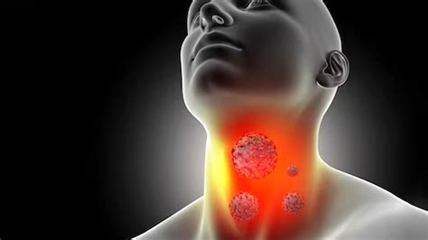 What Does A Swollen Lymph Node Feel Like: Know The Causes And Treatment ...