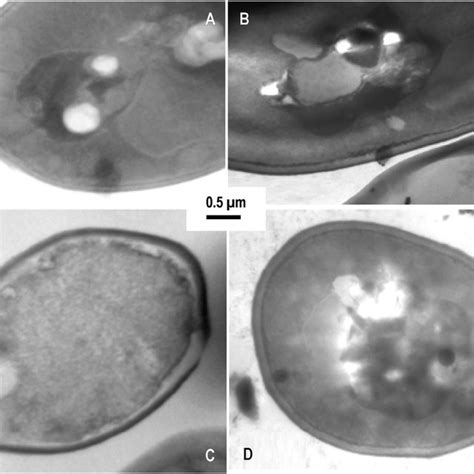 Saccharomyces Cerevisiae Rc0016 Ultrastructure Analysis A Grown In