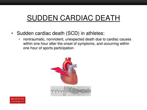 Prevention Of Sudden Cardiac Death In Athletes 12