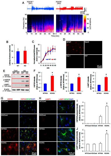 Ijms Free Full Text P2 × 7 Receptor Inhibits Astroglial Autophagy