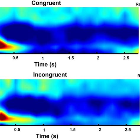 Time Frequency And Topo Map Of Theta Band In Central Region For