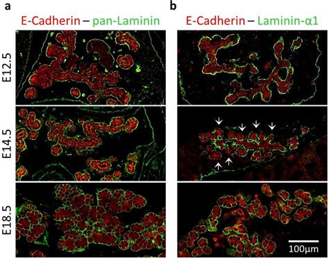 Differential laminin α1 deposition during pancreas development in vivo