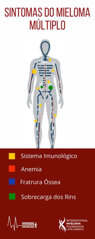 Mieloma múltiple el segundo tipo de cáncer de sangre más común en el