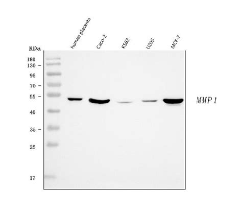 Human Mmp 1 Elisa Kit Price Picokine® Bosterbio