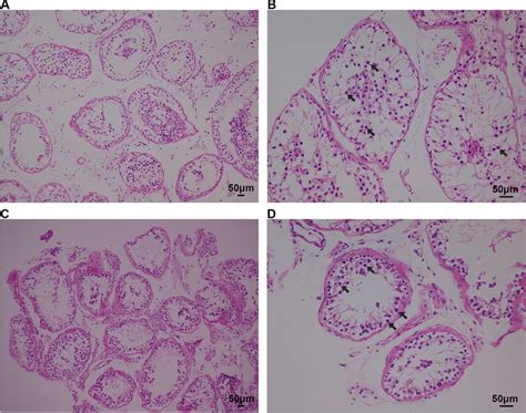 Hande Staining Of Cross Sections Of Testis In Noa Affected Patients