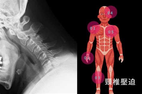 腰椎頸椎 維力骨科診所