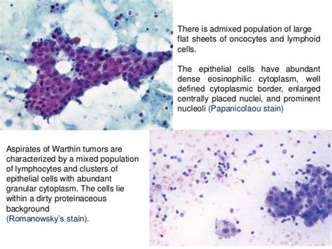 FINE NEEDLE ASPIRATION CYTOLOGY / FNAC