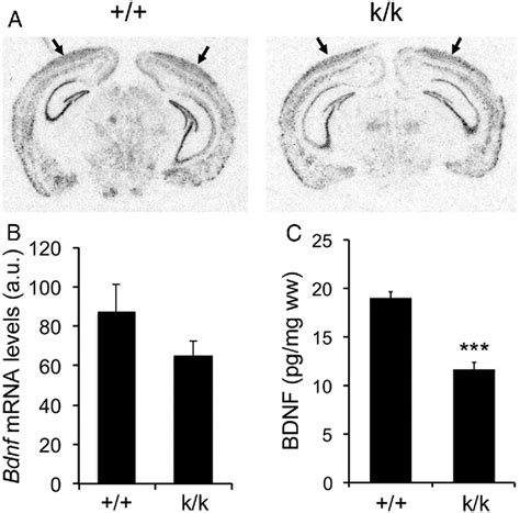 Figure From Dendritic Bdnf Synthesis Is Required For Late Phase Spine