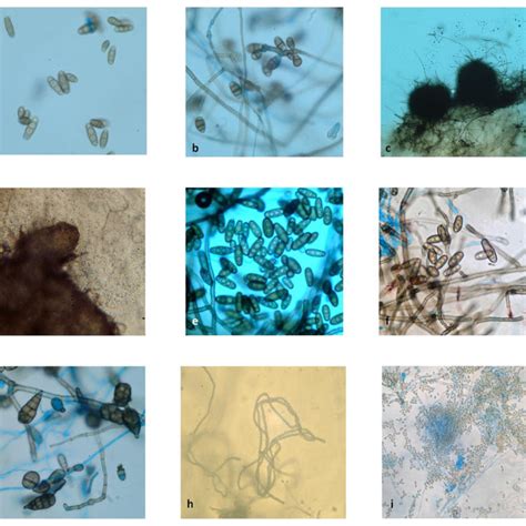 Fungal Endophyte Cultures A Alternaria Alternata B Aspergillus