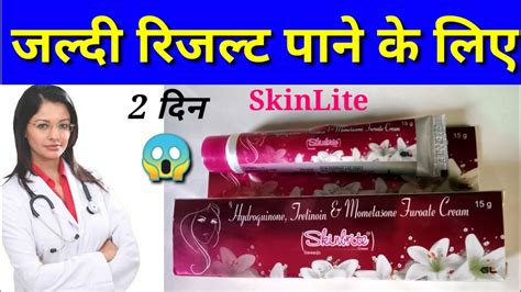 Skinlite Cream Review Uses Side Effects Skinlite Cream YouTube