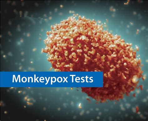 Monkeypox Virus Antigen Rapid Test Kit China Monkeypox Test And Monkeypox