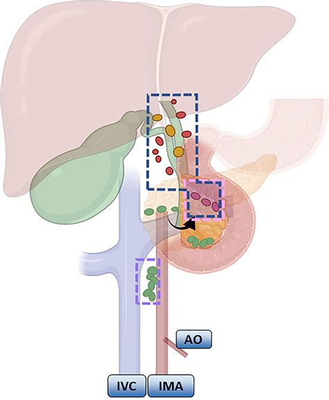 Frontiers Progress In Gallbladder Cancer With Lymph Node Metastasis