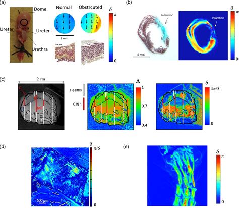 Polarized Light Imaging In Biomedicine Emerging Mueller Matrix