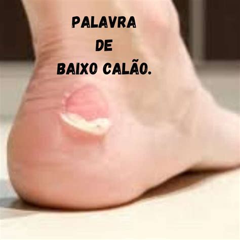 Baixo Calão Ou Escalão - O Que São Palavras De Baixo Calão - FDPLEARN