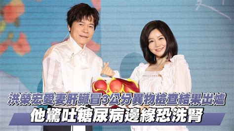 洪榮宏愛妻肝臟冒3公分異物檢查結果出爐 他驚吐糖尿病邊緣恐洗腎｜壹蘋新聞網 Youtube