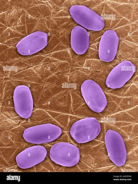 Coloured Scanning Electron Micrograph Sem Of Bacillus Anthracis