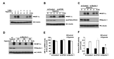 Atg5 Independent Macroautophagy Positively Regulates Hypoxia Induced Download Scientific