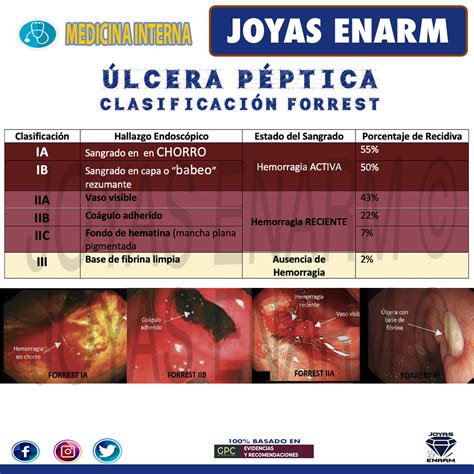 Joyas ENARM On Twitter Sangrado De Tubo Digestivo ENARM