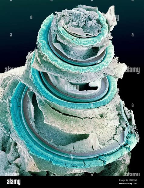 Organ Of Corti Coloured Scanning Electron Micrograph Sem Of The