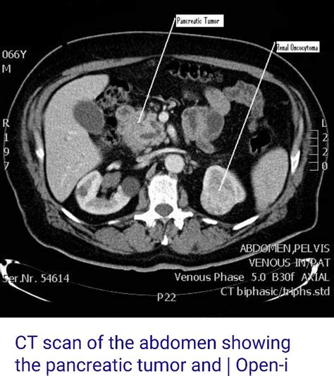 Pin By Liznel Feliberty On Imagenes De Ct Scan Y Mri Ct Scan Scan Mri