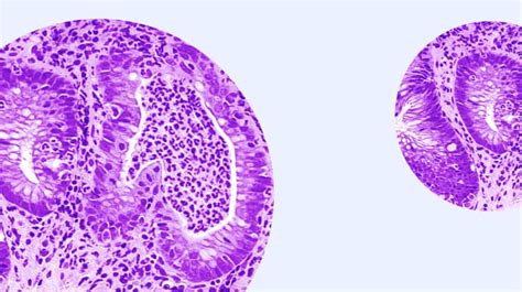 Immunology | AbbVie