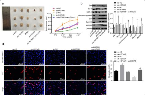 Silenced HOTAIR Enhances Apoptosis And Inhibits Proliferation Of HL 60