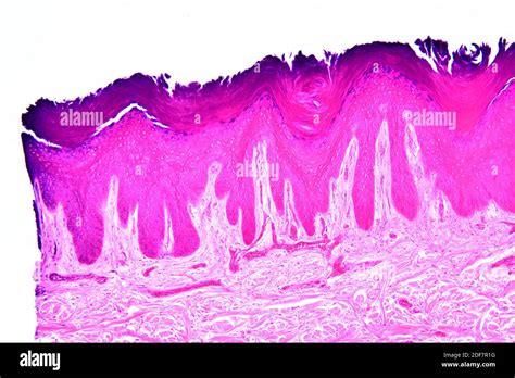 Stratified Squamous Epithelium Hi Res Stock Photography And Images Alamy