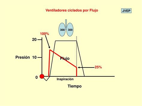 PPT Bases de la Ventilación Mecánica PowerPoint Presentation free