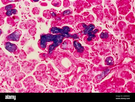 Salivary Gland Light Micrograph Of A Section Through A Submandibular