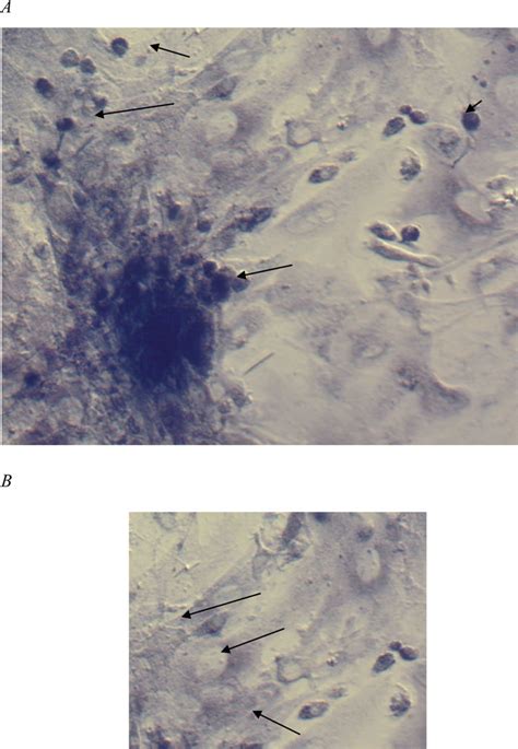 A Cells With Alkaline Phosphatase Staining ×200 Magnification Download Scientific Diagram