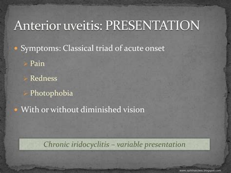 Overview Of Uveitis Part2 Clinical Features Ppt