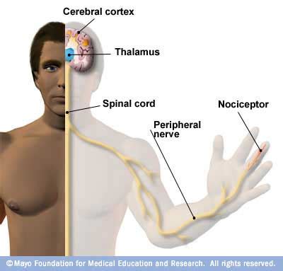 What is Nociceptive pain