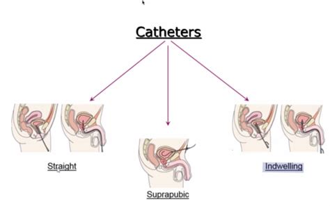 Ch 24 Assisting With Urinary And Bowel Elimination Flashcards Quizlet