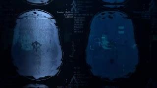 Doctor Free Mobile Porn XXX Sex Videos And Porno Movies IPornTV Net