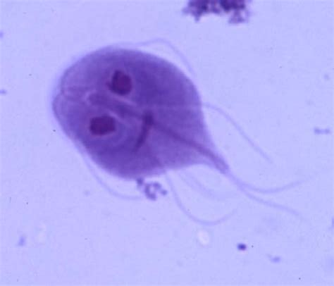 Giardia Lamblia ~ Examination And Happiness