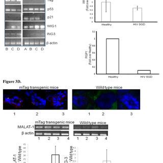 Model Of MALAT 1 Regulation Including Predicted MiRNA At The 3 2 End Of