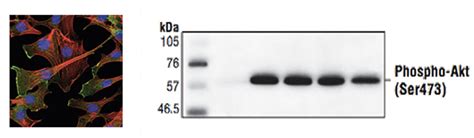 Phospho Specific Antibodies Creative Diagnostics