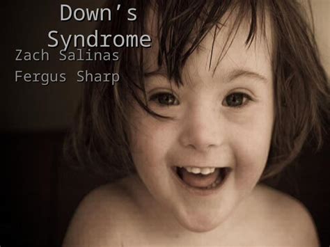 Ppt Downs Syndrome Zach Salinas Fergus Sharp Medical Question 1 How Does A Person Inherit