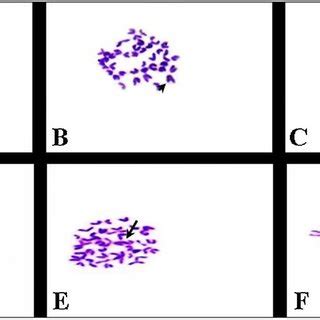 Photomicrographs Of Metaphase Spread From Bone Marrow Cells Of Male